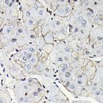 NOTCH1 Antibody in Immunohistochemistry (Paraffin) (IHC (P))