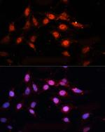 CtBP2 Antibody in Immunocytochemistry (ICC/IF)