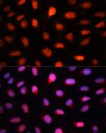 CtBP2 Antibody in Immunocytochemistry (ICC/IF)