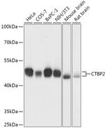 CtBP2 Antibody in Western Blot (WB)