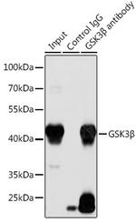 GSK3B Antibody in Immunoprecipitation (IP)