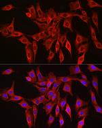 HMGCR Antibody in Immunocytochemistry (ICC/IF)