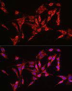 HMGCR Antibody in Immunocytochemistry (ICC/IF)