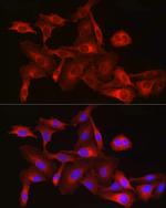 HMGCR Antibody in Immunocytochemistry (ICC/IF)