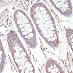 HMGCR Antibody in Immunohistochemistry (Paraffin) (IHC (P))