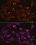 LAMP1 Antibody in Immunocytochemistry (ICC/IF)