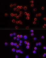 TSG101 Antibody in Immunocytochemistry (ICC/IF)