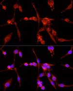 TSG101 Antibody in Immunocytochemistry (ICC/IF)