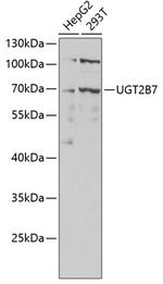 UGT2B7 Antibody in Western Blot (WB)