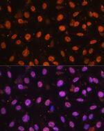 ZEB1 Antibody in Immunocytochemistry (ICC/IF)