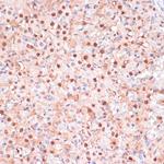 ZEB1 Antibody in Immunohistochemistry (Paraffin) (IHC (P))