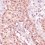 ZEB1 Antibody in Immunohistochemistry (Paraffin) (IHC (P))