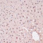 ZEB1 Antibody in Immunohistochemistry (Paraffin) (IHC (P))