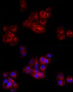 C1 inhibitor Antibody in Immunocytochemistry (ICC/IF)