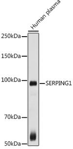 C1 inhibitor Antibody in Western Blot (WB)