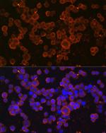 CHI3L1 Antibody in Immunocytochemistry (ICC/IF)