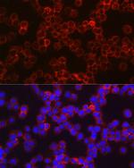 CHI3L1 Antibody in Immunocytochemistry (ICC/IF)