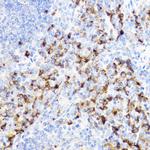 CHI3L1 Antibody in Immunohistochemistry (Paraffin) (IHC (P))