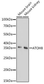 ATOH8 Antibody in Western Blot (WB)