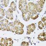 HDAC6 Antibody in Immunohistochemistry (Paraffin) (IHC (P))