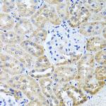 HDAC6 Antibody in Immunohistochemistry (Paraffin) (IHC (P))