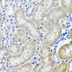 HDAC6 Antibody in Immunohistochemistry (Paraffin) (IHC (P))