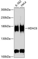 HDAC6 Antibody in Western Blot (WB)