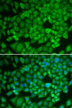 NR0B1 Antibody in Immunocytochemistry (ICC/IF)