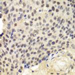 KPNA1 Antibody in Immunohistochemistry (Paraffin) (IHC (P))