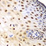 KPNA1 Antibody in Immunohistochemistry (Paraffin) (IHC (P))