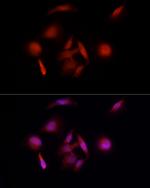 E6AP Antibody in Immunocytochemistry (ICC/IF)