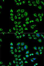 CD1d Antibody in Immunocytochemistry (ICC/IF)