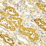 BIN1 Antibody in Immunohistochemistry (Paraffin) (IHC (P))