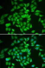 CK1 epsilon Antibody in Immunocytochemistry (ICC/IF)