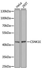 CK1 epsilon Antibody in Western Blot (WB)