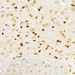 XRCC2 Antibody in Immunohistochemistry (Paraffin) (IHC (P))