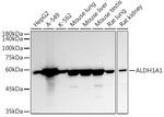 ALDH1A1 Antibody in Western Blot (WB)