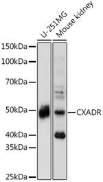 CAR Antibody in Western Blot (WB)