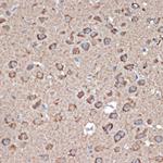 GluR1 Antibody in Immunohistochemistry (Paraffin) (IHC (P))