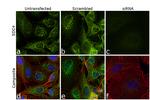 Syndecan 4 Antibody