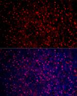 Arginase 1 Antibody in Immunocytochemistry (ICC/IF)