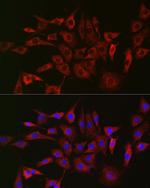 GLB1 Antibody in Immunocytochemistry (ICC/IF)