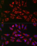 GLB1 Antibody in Immunocytochemistry (ICC/IF)