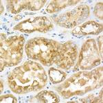 GLB1 Antibody in Immunohistochemistry (Paraffin) (IHC (P))