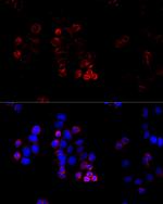 ABCG8 Antibody in Immunocytochemistry (ICC/IF)