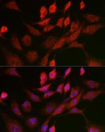 ANT Antibody in Immunocytochemistry (ICC/IF)