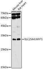 ANT Antibody in Western Blot (WB)