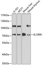 IL12RB1 Antibody in Western Blot (WB)