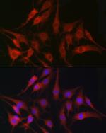 Fascin Antibody in Immunocytochemistry (ICC/IF)