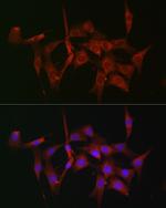 Fascin Antibody in Immunocytochemistry (ICC/IF)